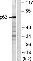 p63 Polyclonal Antibody