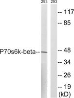 p70 S6 kinase β Polyclonal Antibody