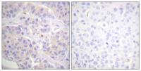 p130 Cas Polyclonal Antibody