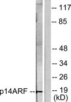 p14ARF Polyclonal Antibody