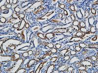 p15 Polyclonal Antibody