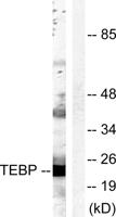 p23 Polyclonal Antibody