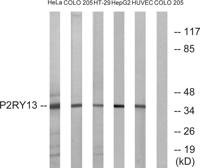 P2RY13 Polyclonal Antibody