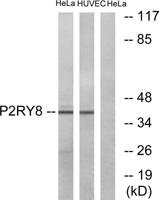 P2RY8 Polyclonal Antibody