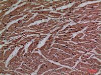 P2X3 Polyclonal Antibody