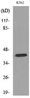 P2X3 Polyclonal Antibody