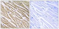 P311 Polyclonal Antibody