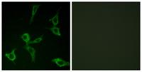 Olfactory receptor 2AG1/2 Polyclonal Antibody