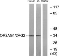 Olfactory receptor 2AG1/2 Polyclonal Antibody