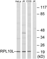 Ribosomal Protein L10L Polyclonal Antibody