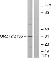 Olfactory receptor 2T2/35 Polyclonal Antibody