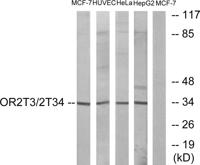 Olfactory receptor 2T3/34 Polyclonal Antibody