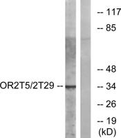 Olfactory receptor 2T5/2T29 Polyclonal Antibody