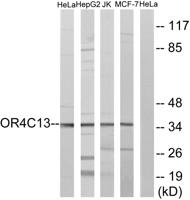 Olfactory receptor 4C13 Polyclonal Antibody