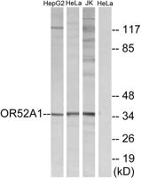 Olfactory receptor 52A1 Polyclonal Antibody