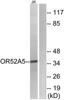 Olfactory receptor 52A5 Polyclonal Antibody