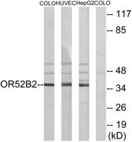 Olfactory receptor 52B2 Polyclonal Antibody