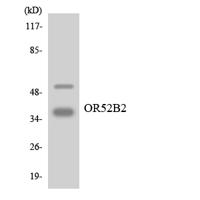 Olfactory receptor 52B2 Polyclonal Antibody