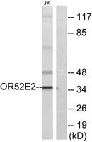 Olfactory receptor 52E2 Polyclonal Antibody