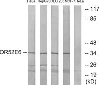 Olfactory receptor 52E6 Polyclonal Antibody