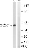 Olfactory receptor 52K1 Polyclonal Antibody