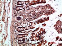 OSM Polyclonal Antibody