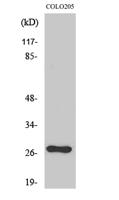 OTUB2 Polyclonal Antibody