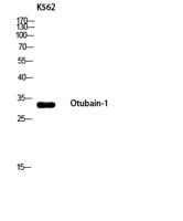 Otubain-1 Polyclonal Antibody