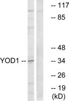 OTUD2 Polyclonal Antibody