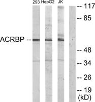 OY-TES-1 Polyclonal Antibody