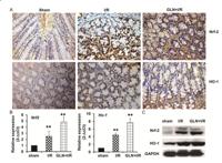 Nrf2 Polyclonal Antibody