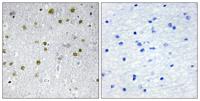 NRIP2 Polyclonal Antibody