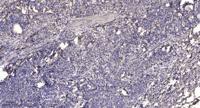 NSE2 Polyclonal Antibody