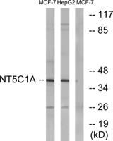 NT5C1A Polyclonal Antibody