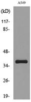 NTCP Polyclonal Antibody