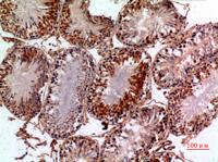 NTE Polyclonal Antibody