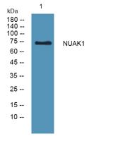 NUAK1 Polyclonal Antibody