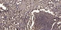 Ribosomal Protein L14 Polyclonal Antibody