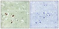 Ribosomal Protein L15 Polyclonal Antibody