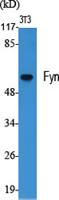 Fyn Polyclonal Antibody