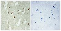 Ribosomal Protein L26L Polyclonal Antibody