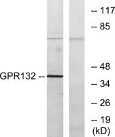 G2A Polyclonal Antibody