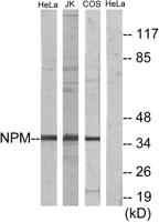 Nucleophosmin Polyclonal Antibody