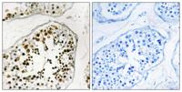 NuMA Polyclonal Antibody