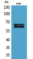 NUMB Polyclonal Antibody