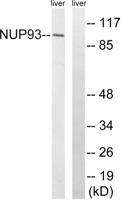 Nup93 Polyclonal Antibody