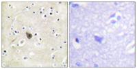 PKD2 Polyclonal Antibody