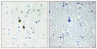 Pki α Polyclonal Antibody