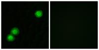 PKI β Polyclonal Antibody