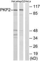 Plakophilin 2 Polyclonal Antibody